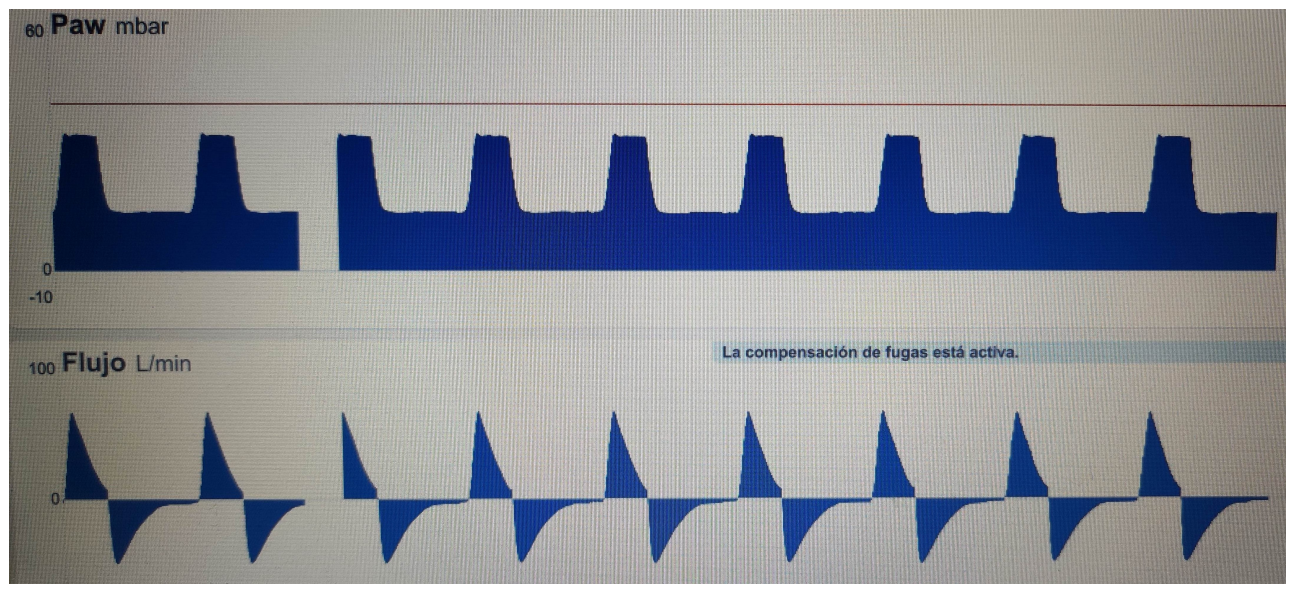 Imagen de la pregunta 14 del EIR 2024
